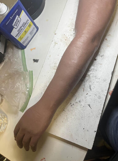 Fresh casting from arm mold